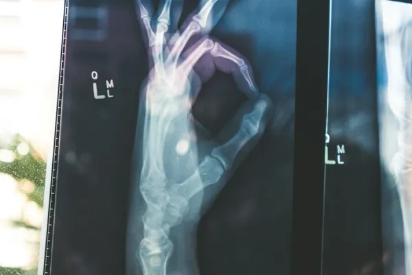 Tratamiento de fracturas y traumatología de urgencia en San Pedro Sula por el Dr. Erick Ponce
