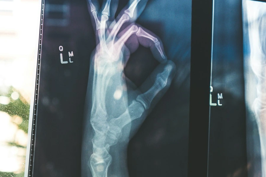 Tratamiento de fracturas y traumatología de urgencia en San Pedro Sula por el Dr. Erick Ponce